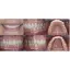 رینگ فلاش گودکس Godox MF12-DK1 Dental Macro Sony